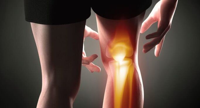 Symptômes de l'arthrose