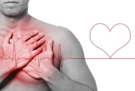 Crise cardiaque comme cause de maux de dos sous l'omoplate gauche.