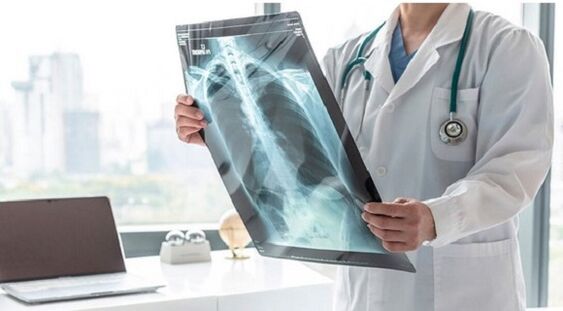 Diagnostic radiologique de la douleur sous l'omoplate gauche.