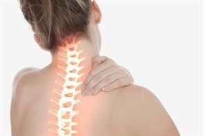 Ostéochondrose cervicale chez une femme.